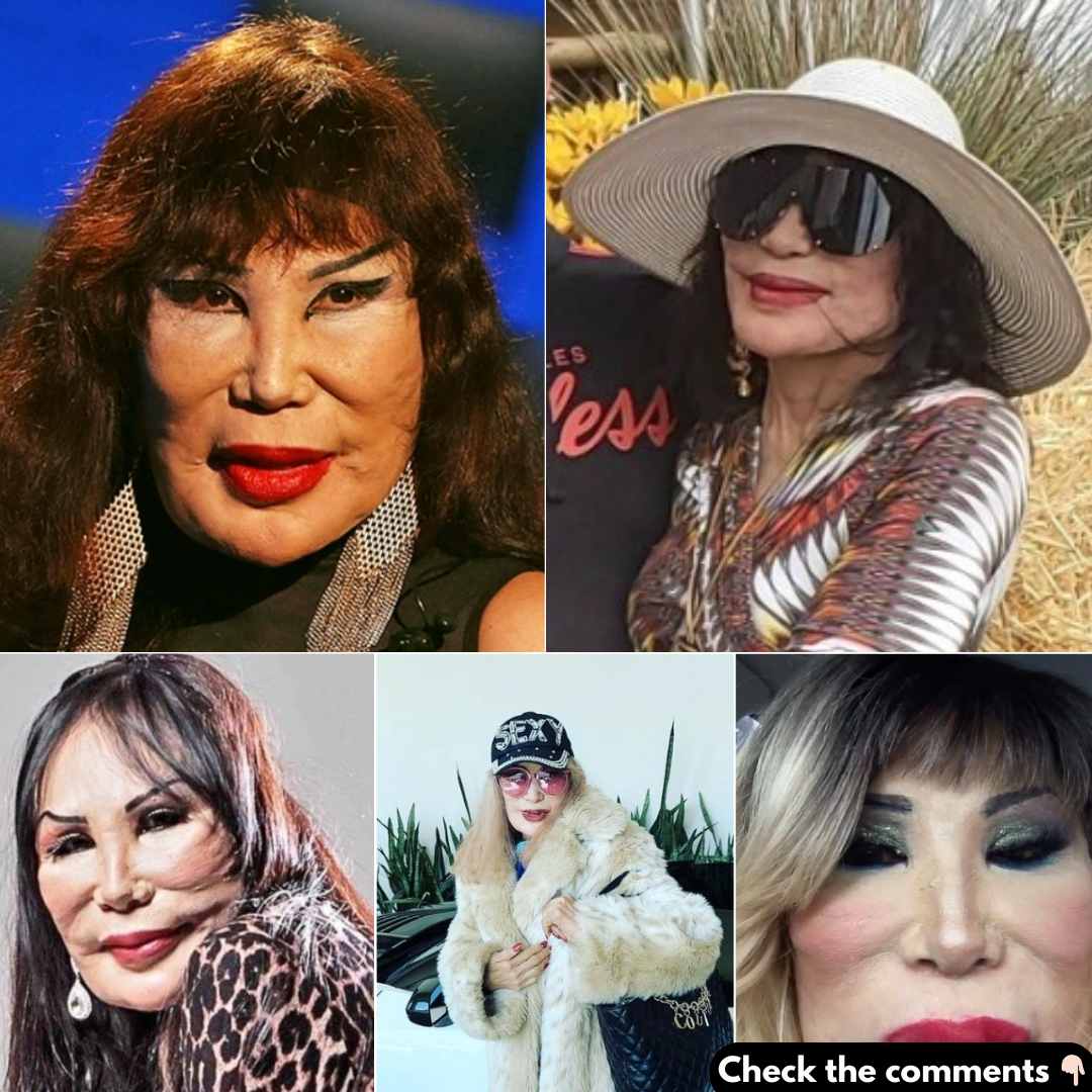 The sad tragedy behind Lyn May’s face The sad tragedy behind Lyn May’s face