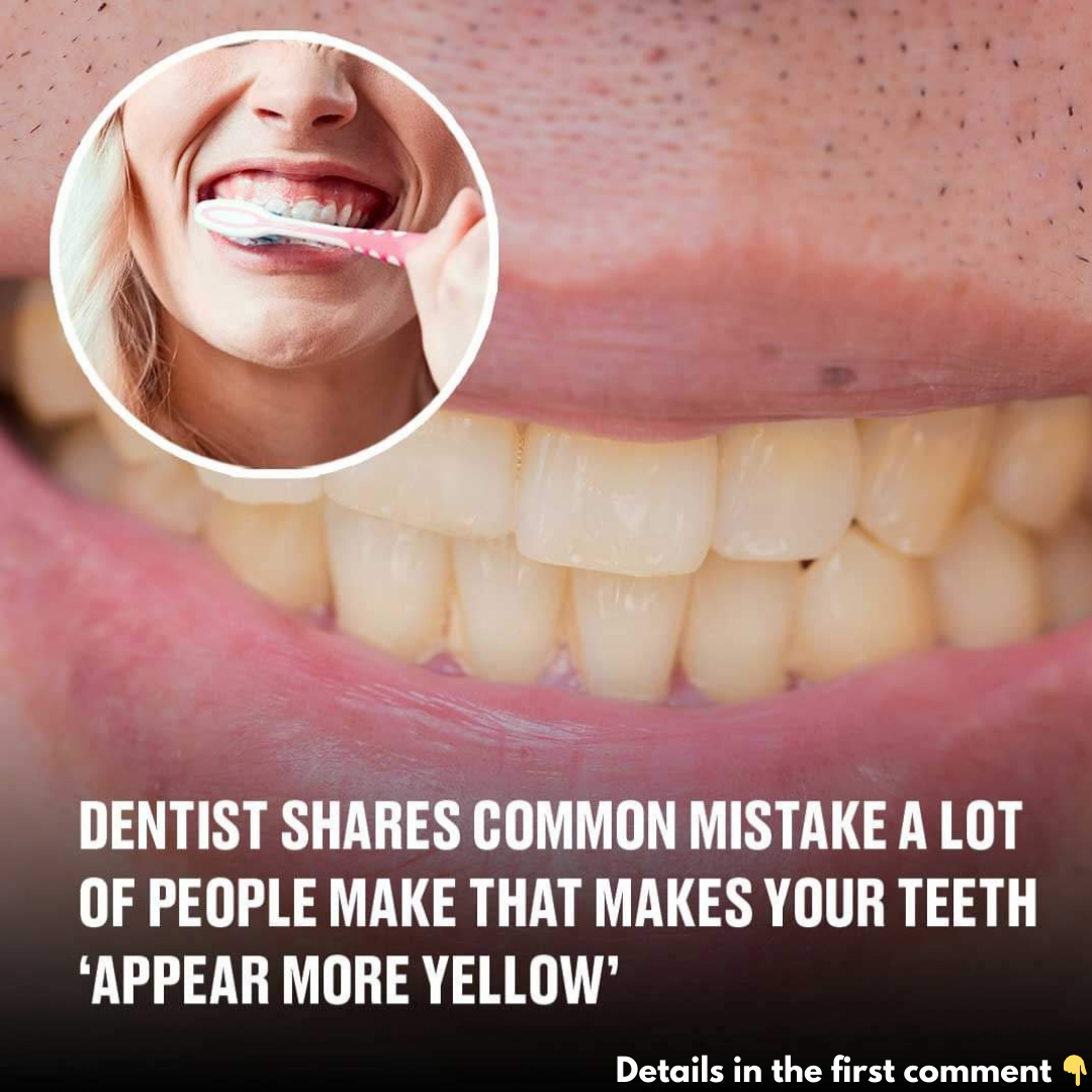 People Often Make This Mistake Which Leads to Yellow Teeth, Dentist Says People Often Make This Mistake Which Leads to Yellow Teeth, Dentist Says