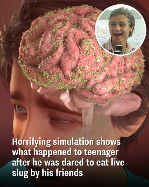 Horrifying simulation shows what happened to teenager after he was dared to eat live slug by his friends Horrifying simulation shows what happened to teenager after he was dared to eat live slug by his friends