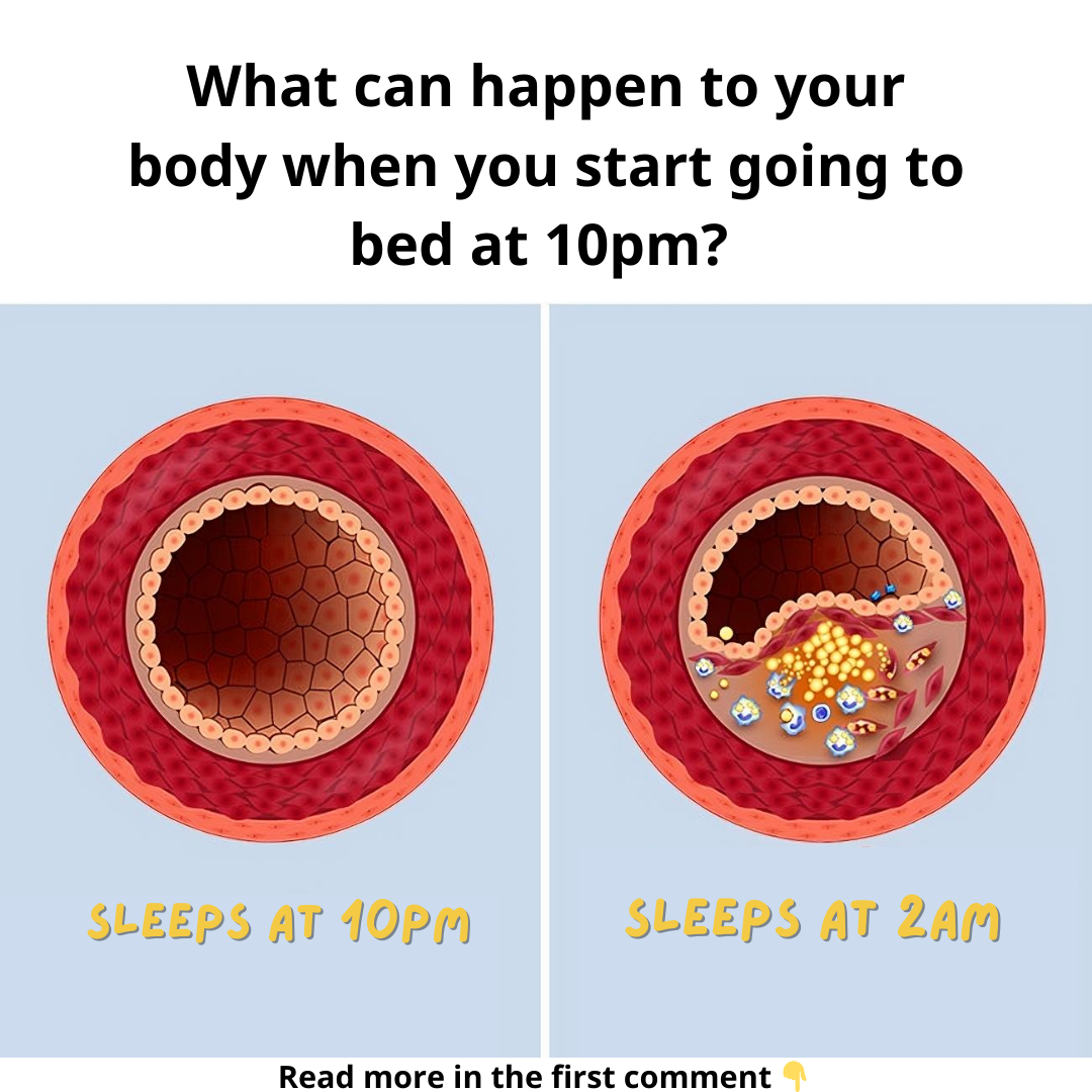 What can happen to your body when you start going to bed at 10 p.m What can happen to your body when you start going to bed at 10 p.m