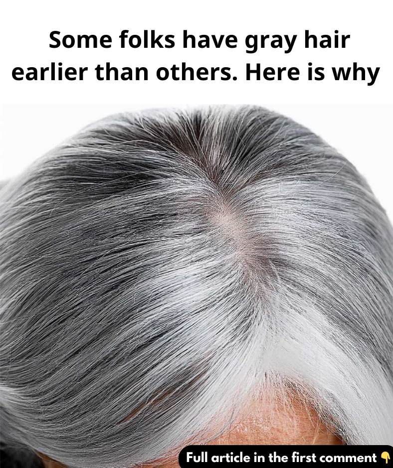 Some folks have gray hair earlier than others. Here is why? Some folks have gray hair earlier than others. Here is why?