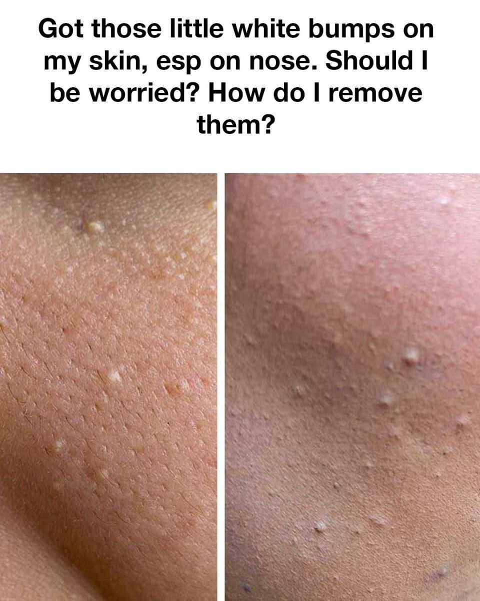 I really am annoyed by these! I really am annoyed by these!