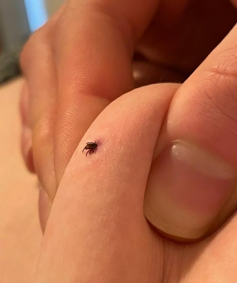 Actions To Take If You Discover a Tick in Your Home Actions To Take If You Discover a Tick in Your Home