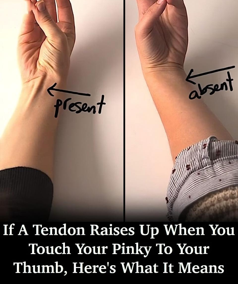 If a Tendon Raises Up When You Touch Your Pinky to Your Thumb, Here’s What It Could Mean If a Tendon Raises Up When You Touch Your Pinky to Your Thumb, Here’s What It Could Mean