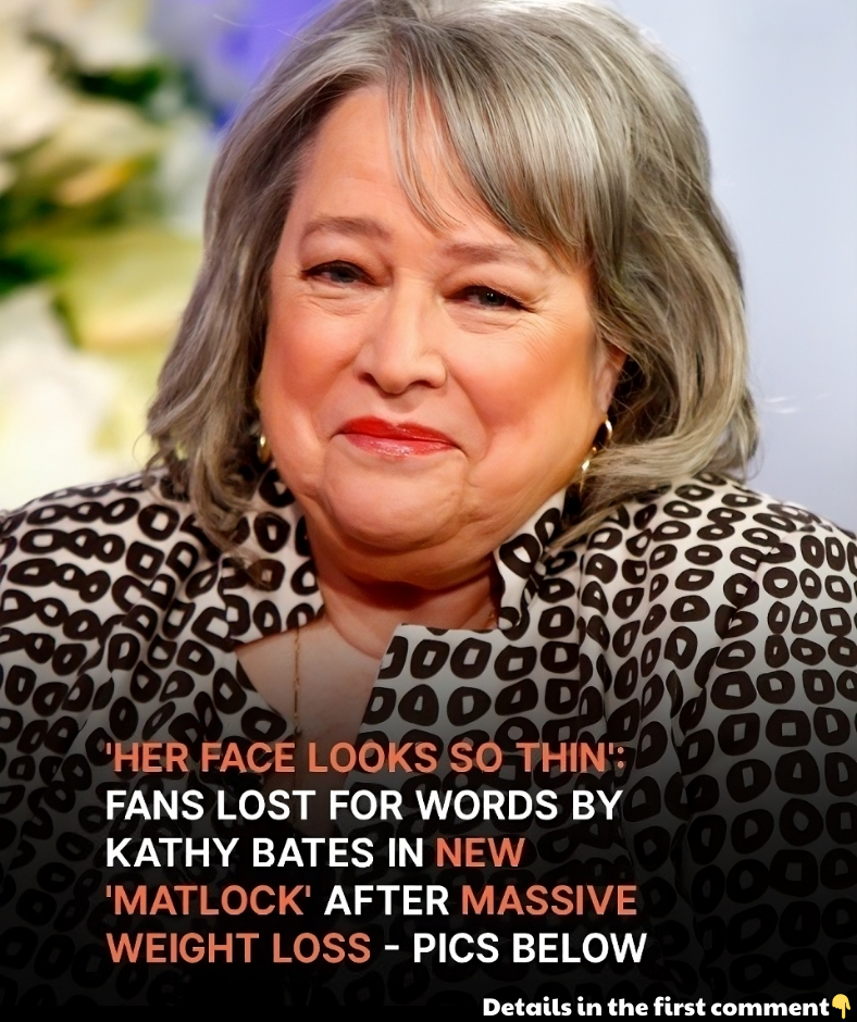 New ‘Matlock’ with ‘So Thin’ 76-Year-Old Kathy Bates Is on Everyone’s Lips: ‘OMG, What Happened to Her?’ New ‘Matlock’ with ‘So Thin’ 76-Year-Old Kathy Bates Is on Everyone’s Lips: ‘OMG, What Happened to Her?’