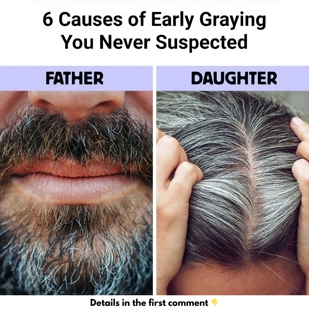 6 Causes of Early Graying You Never Suspected 6 Causes of Early Graying You Never Suspected
