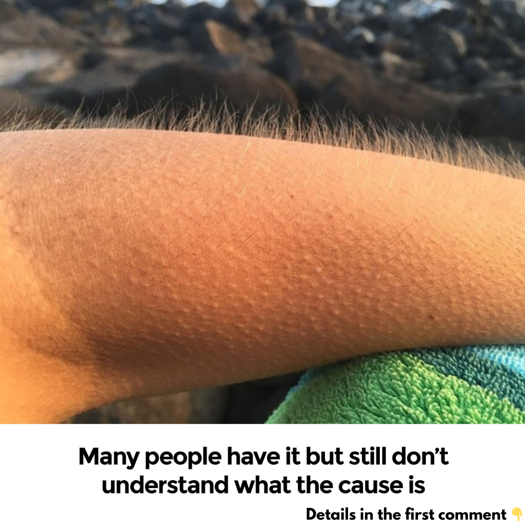 What causes us to get goosebumps when experiencing strong emotions