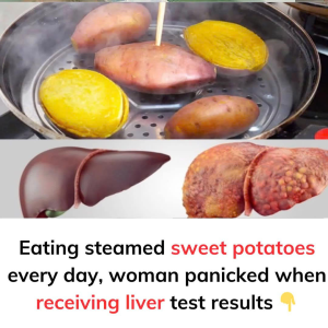 Eating steamed sweet potatoes every day, woman panicked when receiving liver test results