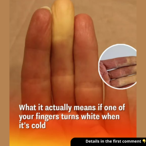 What it actually means if one of your fingers turns white when it’s cold