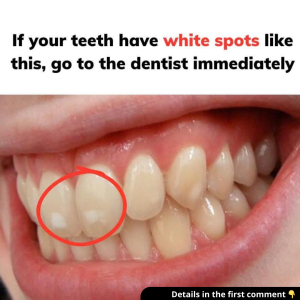 For those who don’t know