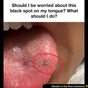 Asking for a friend..