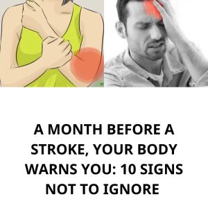 A month before a stroke, your body warns you: 10 signs not to ignore
