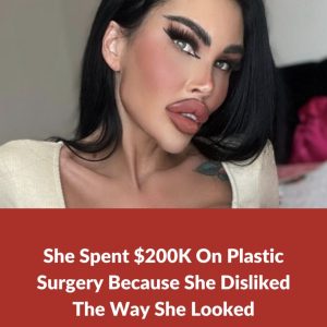 Plastic surgery addict spends 0K on plastic surgery