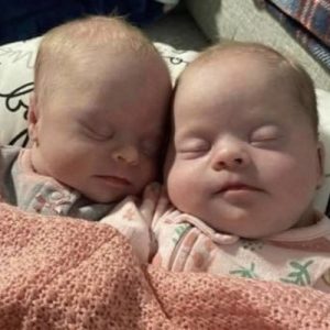 Mom of twins with Down syndrome shuts down critics