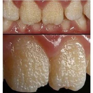 Be careful!! This is what your teeth will become when you eat…