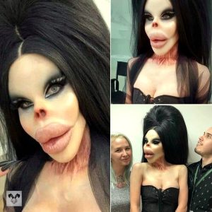 Is This a 68-Year-Old Human ‘Barbie Doll’ After Botched Plastic Surgeries?