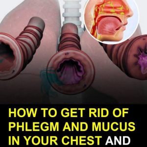 How To Get Rid Of Phlegm And Mucus In Your Throat And Chest On Your Own