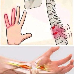 Reasons You Could Have Numbness or Tingling Sensations in Your Hands