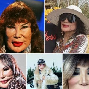 The sad tragedy behind her face. The untold tragedy will leave you speechless