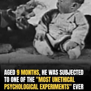 The Heartbreaking Fate Of ‘Little Albert’: Child Subject Of Historic Study Died At Just Six