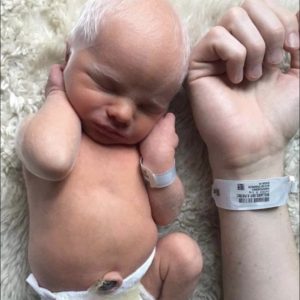 Albino baby mocked for white hair is happy and healthy years later