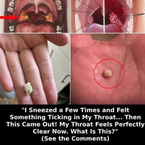 Here’s What You Need to Know