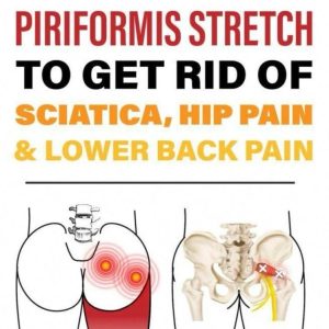 Effect Piriformis Stretch to Ease Lower Back, Hip, and Sciatic Nerve Pain