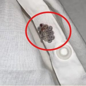 I Shocked when I discovered these small balls in my bed. Here’s what they were.