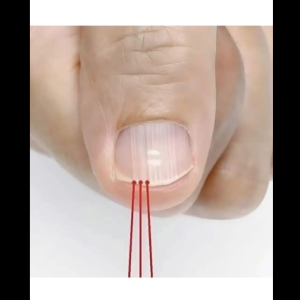 What vertical lines on your nails really mean – the truth will surprise you