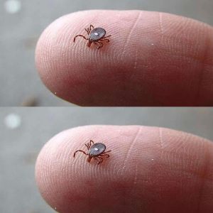 Bitten by a Lone Star Tick? Here’s What You Need to Know—and What to Do Immediately