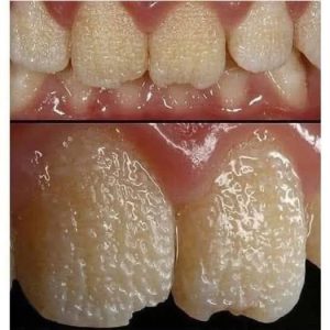This is what your teeth will become when you eat…