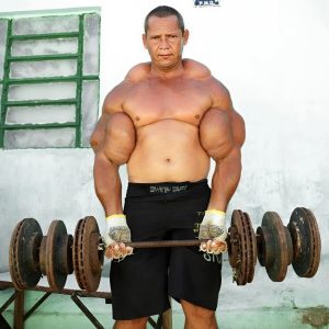 You Won’t Believe What This Man Did for Attention